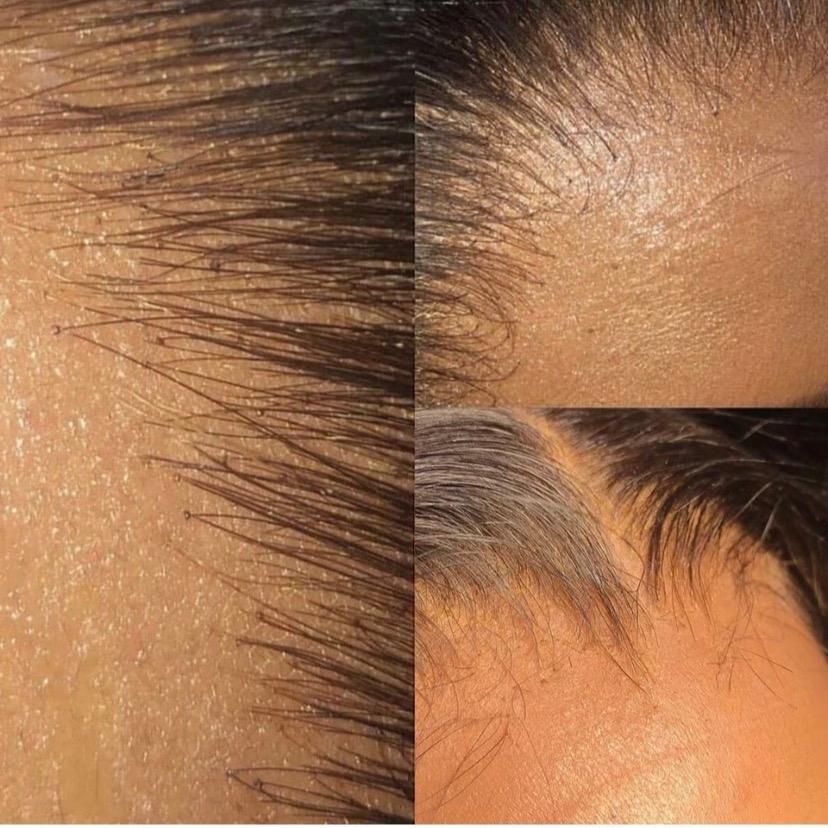 Burmese or Vietnamese Straight HD Lace Closures & Frontals (5x5, 6x6, 13x4) - BrisRawHairCo